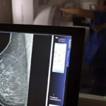 Câncer de mama: uma em cada três pacientes tem menos de 50 anos