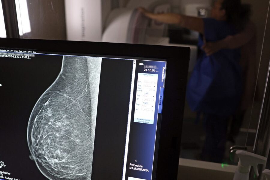 Câncer de mama: uma em cada três pacientes tem menos de 50 anos