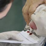 Saúde aumenta em 30% recursos para teste do pezinho