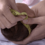 Governo regulamenta indenização e pensão a vítimas do vírus Zika