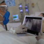 Covid é principal causa de internação por síndrome respiratória no Rio