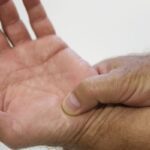 Política para pacientes reumáticos pode criar modelo a ser replicado