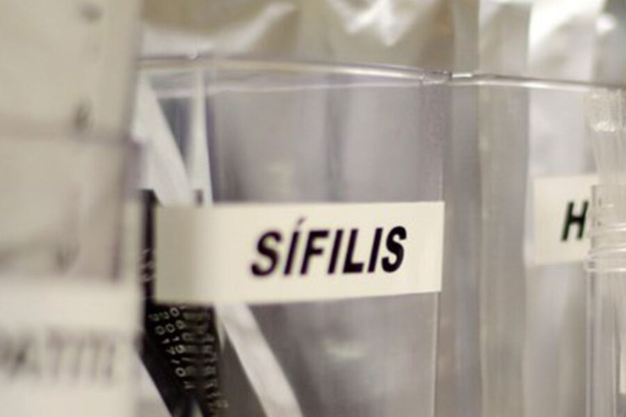 Centro de SP tem testagem grátis de HIV, hepatite, síflis e gonorreia
